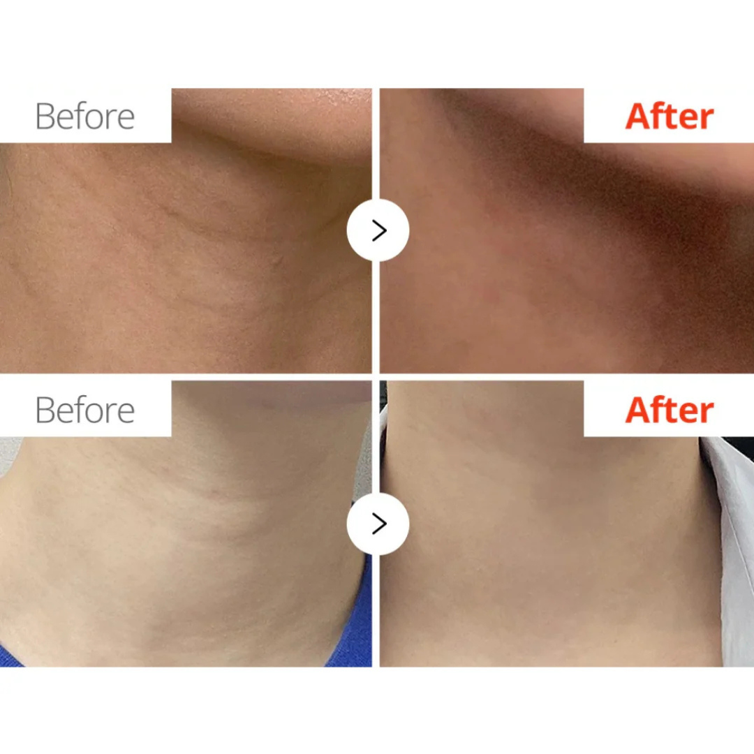 Necksphalt ECM Ceramide Neck Cream