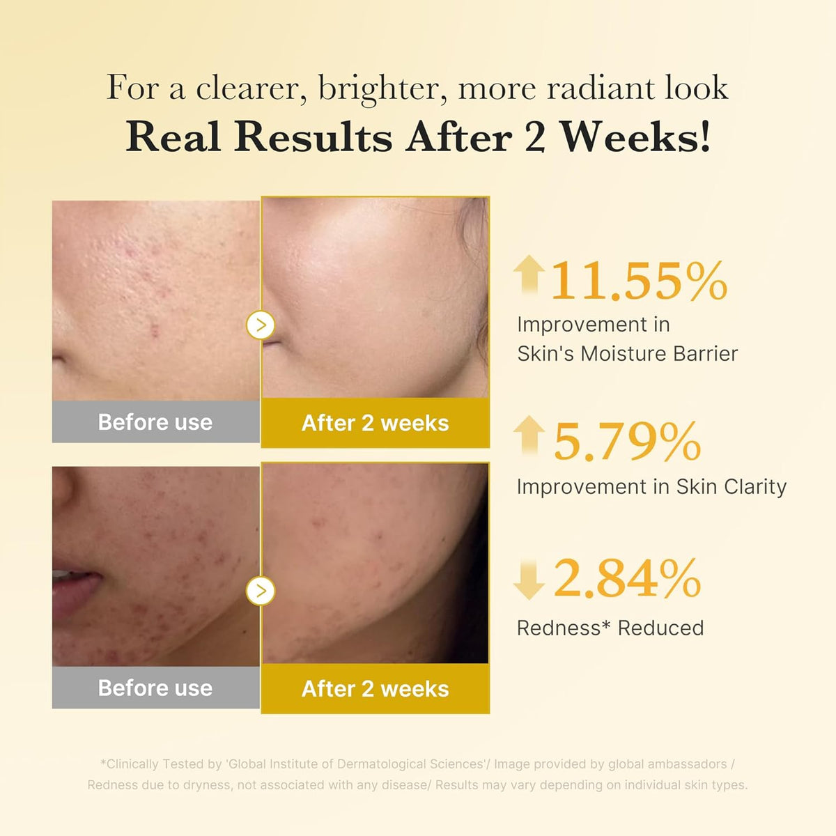 Kojic Acid Turmeric Niacinamide Serum