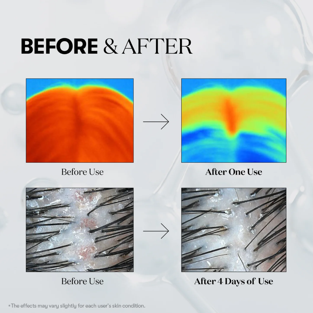 PDRN Reedle Shot Hair Ampoule 700dL