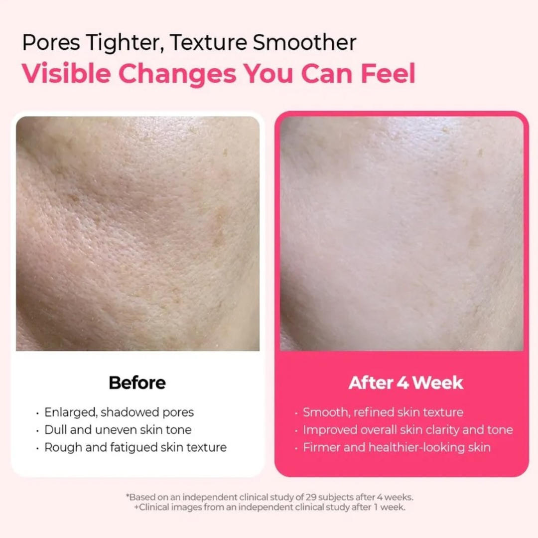 Cemenrete Cyano Pink Spicule Serum