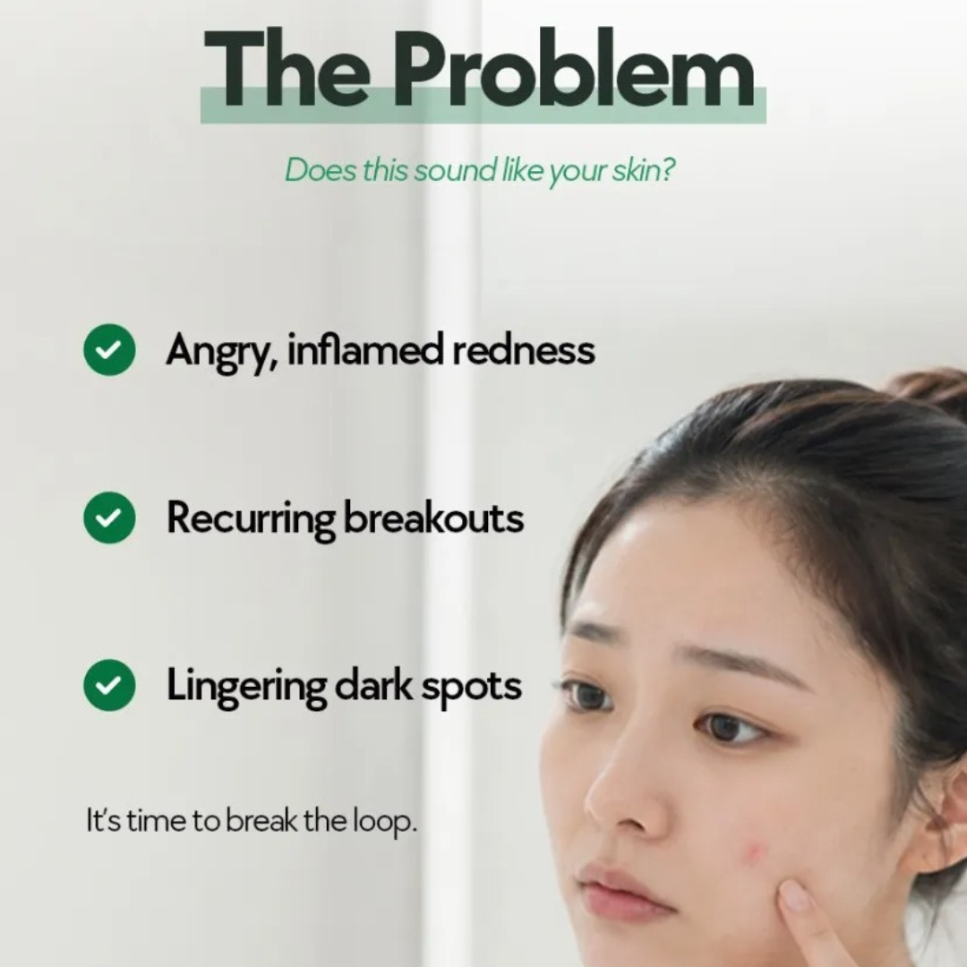 A-Control 10% Azelaic Acid Serum
