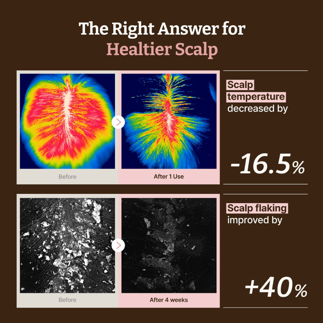 Advanced PDRN Hair Density Scalp Serum