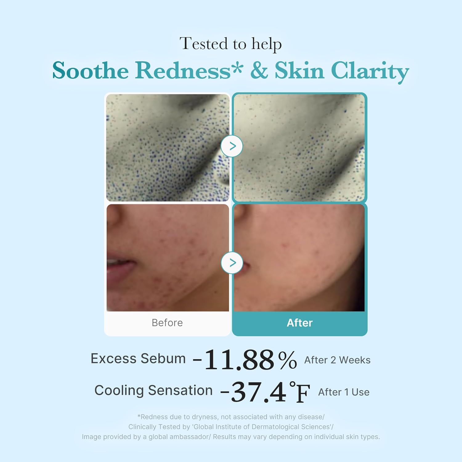 Azelaic Acid Niacinamide Clear Toner