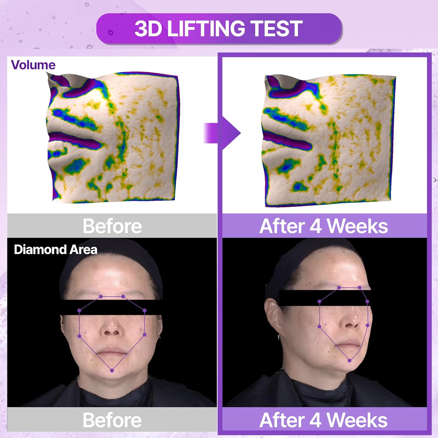 Probioderm 3D Lifting Ampoule