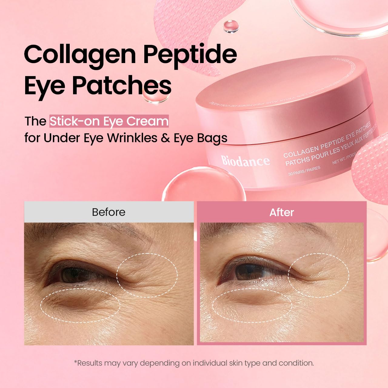 Collagen Peptide Eye Patches