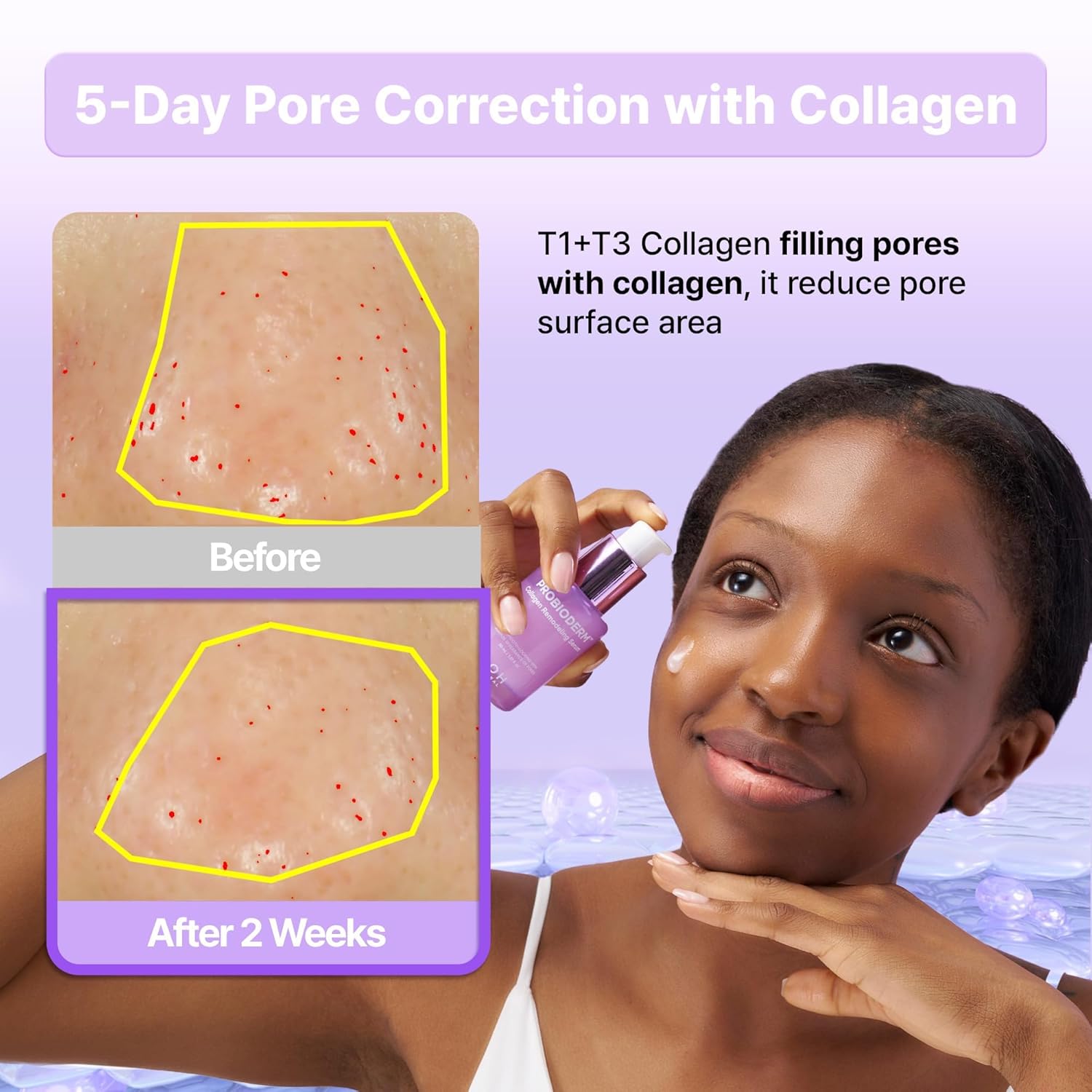 Probioderm Collagen Remodeling Serum