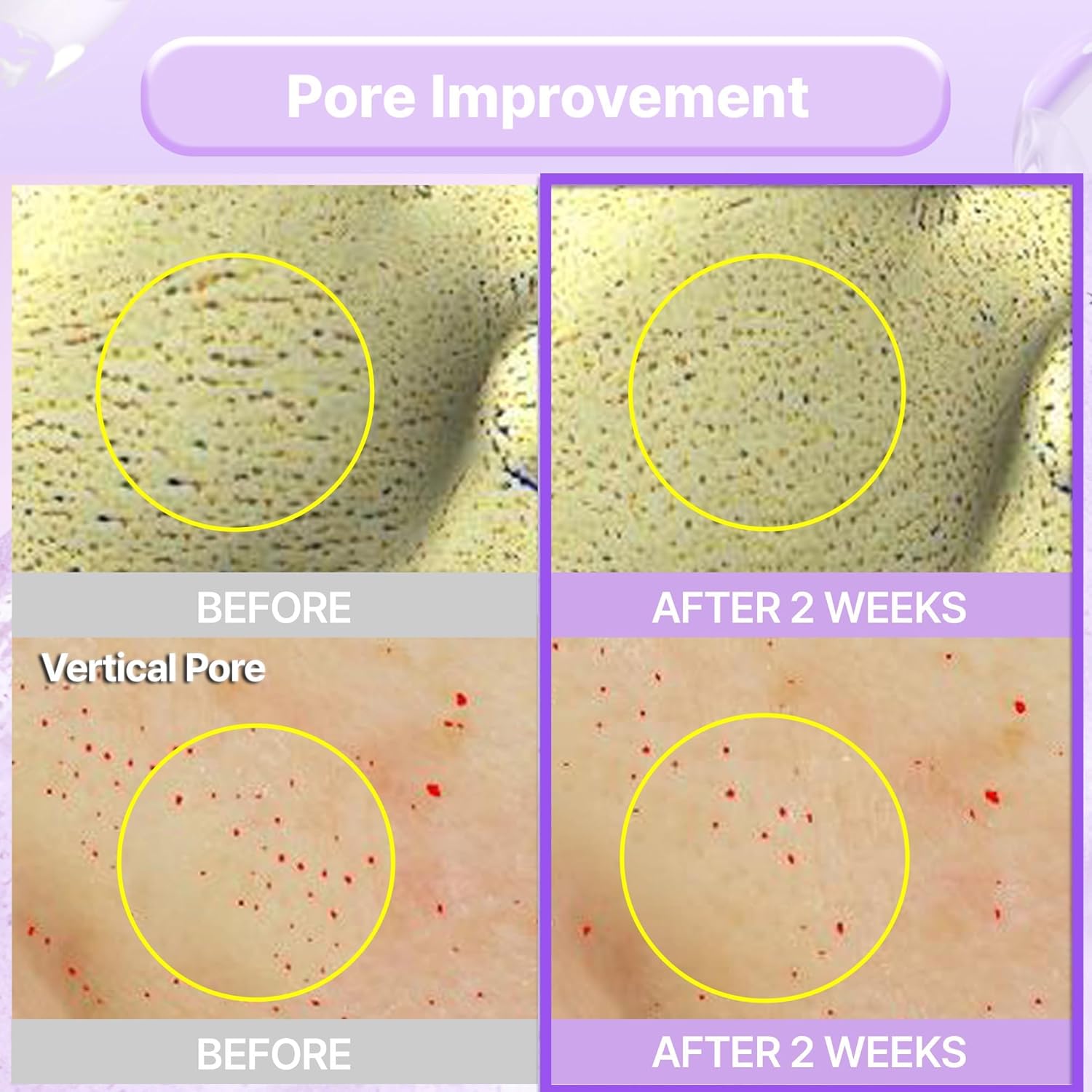 Probioderm Collagen Remodeling Serum