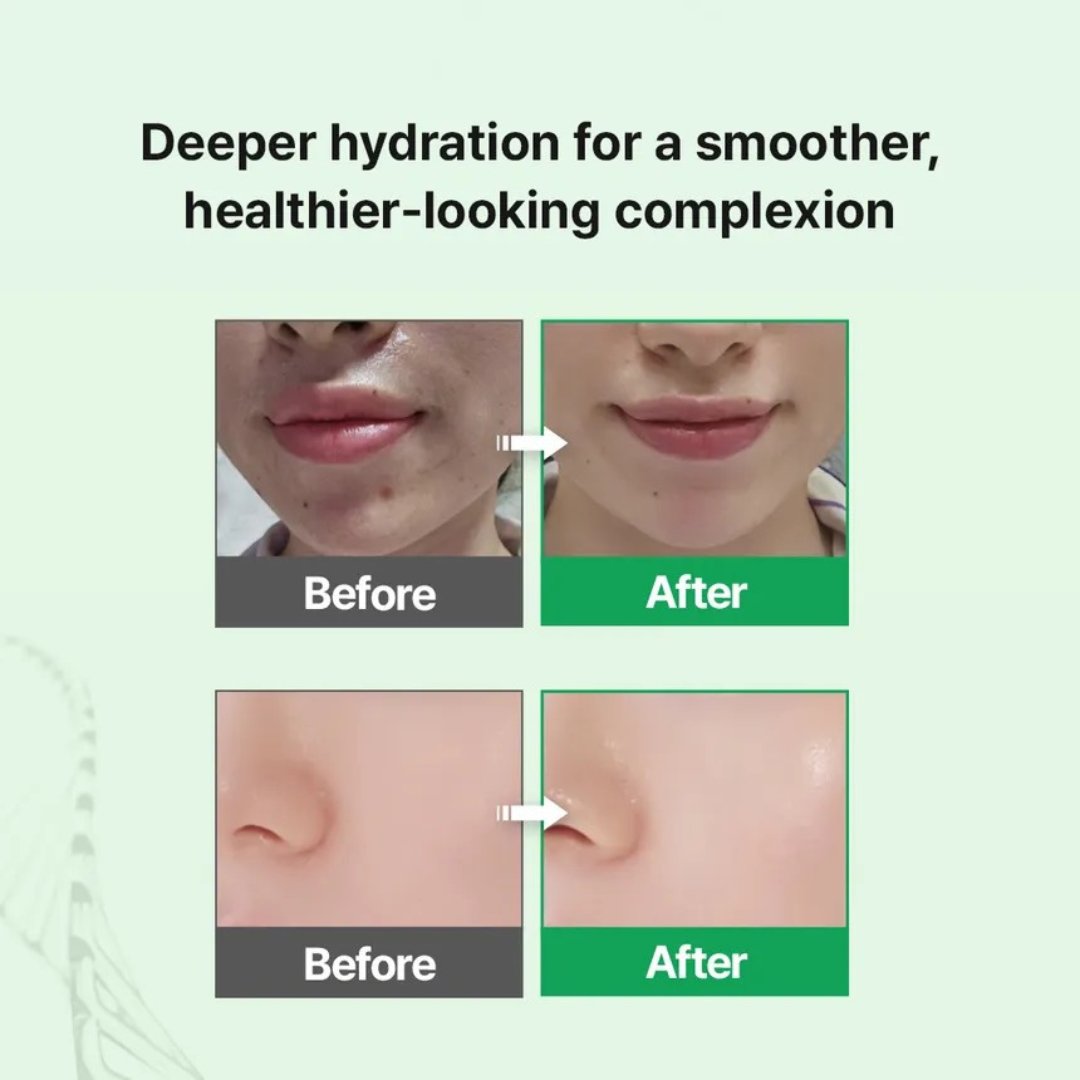 EGF Skin Barrier Hydro Ampoule