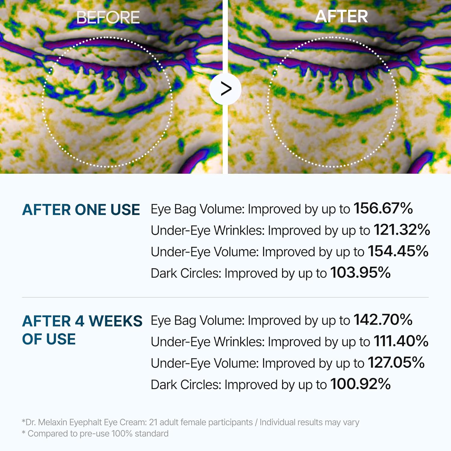 Eyephalt Eyebag Cream