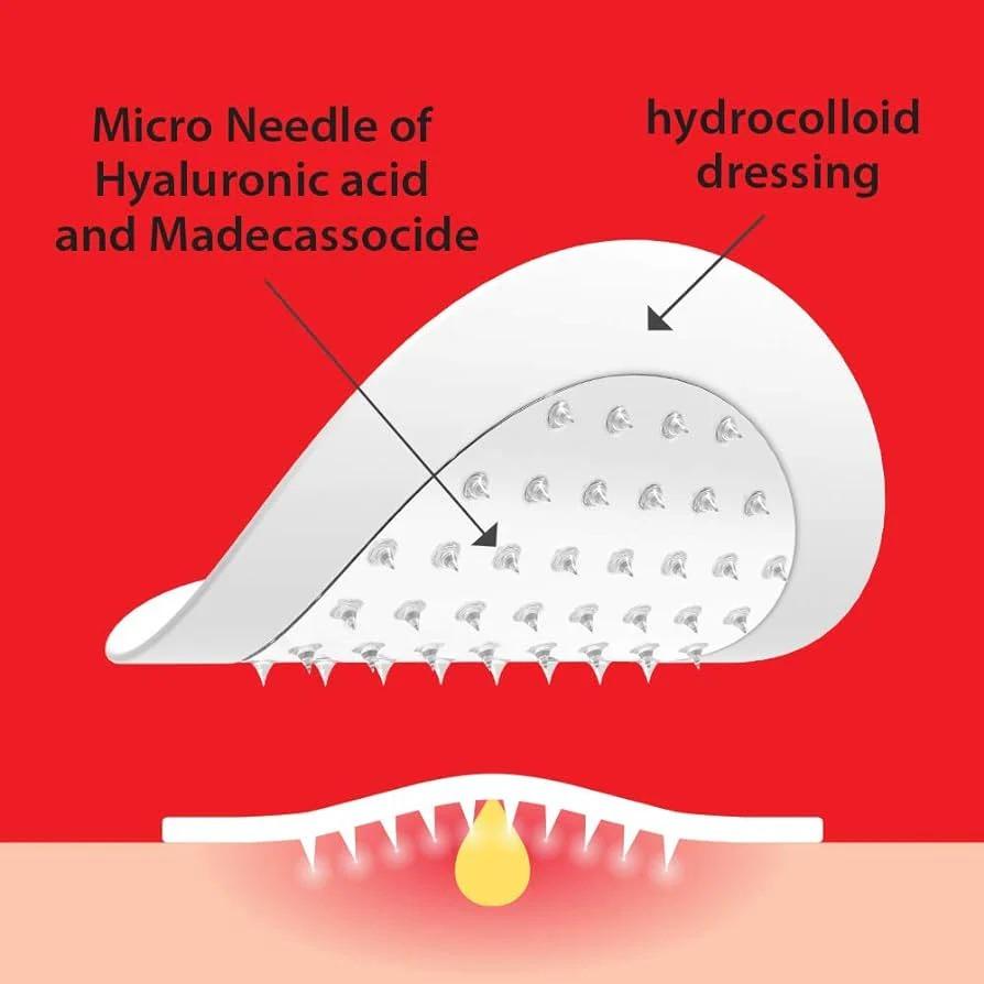 Trouble Clear Needle Patch
