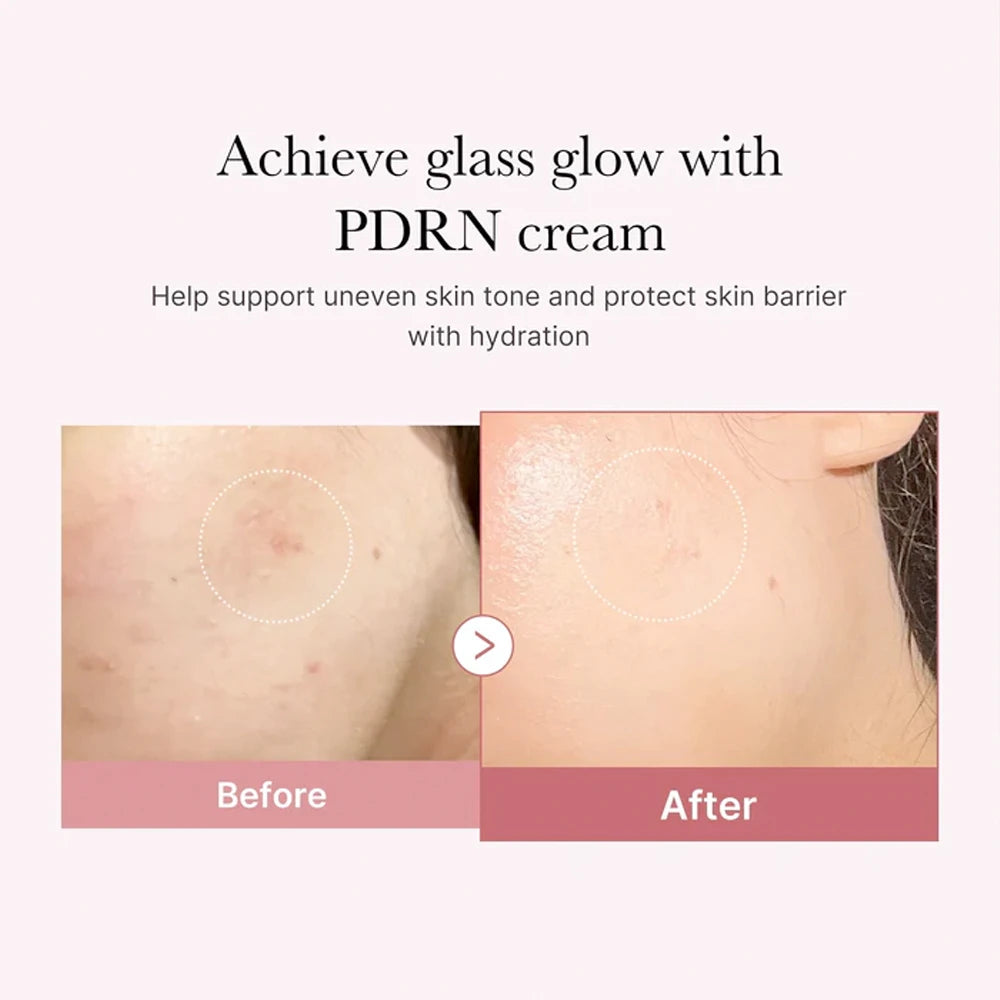 PDRN Pink Hyaluronic Moisturizing Cream